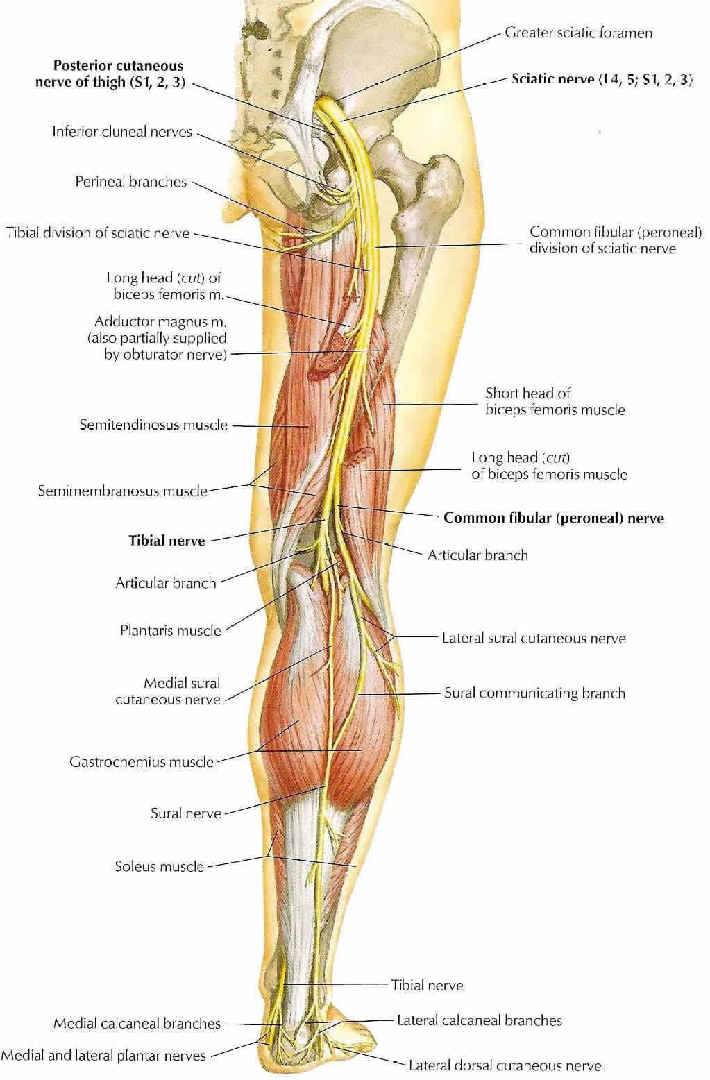 ACC Sciatica