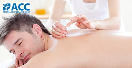 Hiệu quả của châm cứu trong chữa trị thoái hóa cột sống