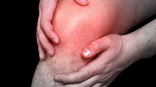 Long term relief of knee pain due to osteoarthritis! The ACC approach!