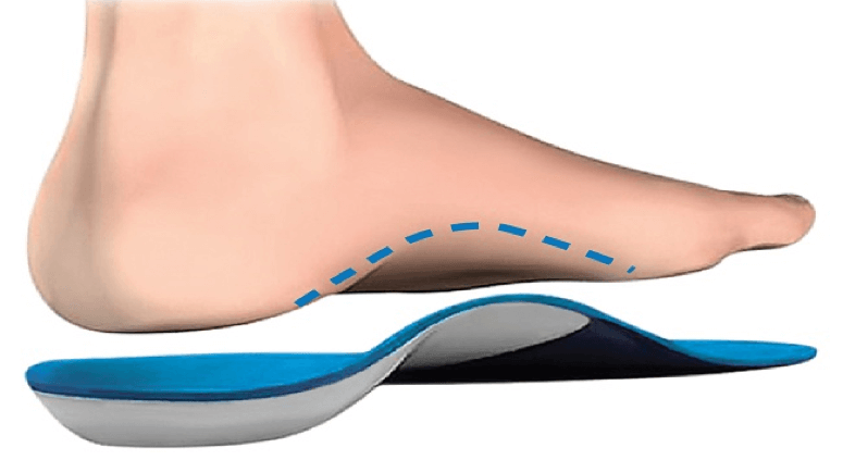 Orthotics | Foot Orthoses | ACC Chiropractic Clinic