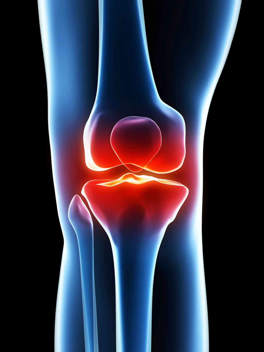 knee pain images