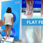 flat-feet-3
