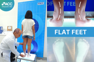 flat-feet-3