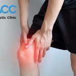 What is Knee Effusion