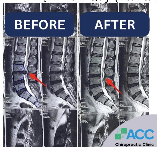 natural physiological curve