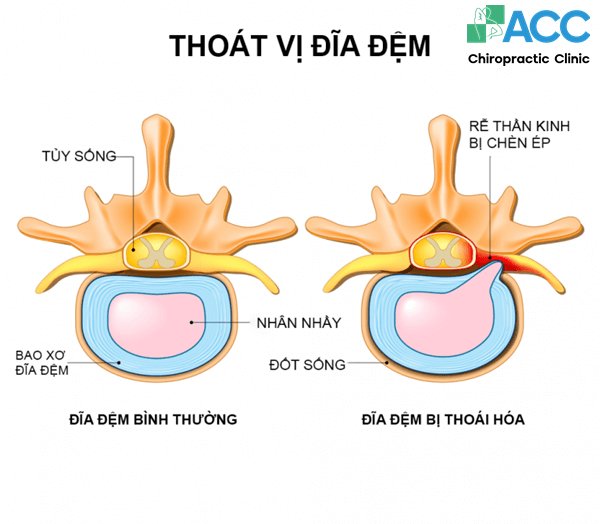 injuries causing upper back pain