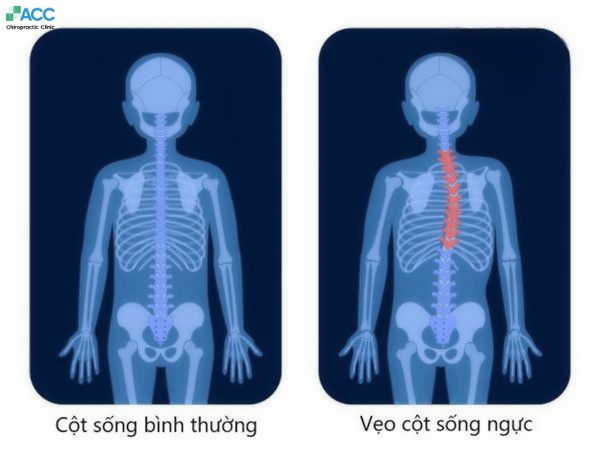 non surgical middle back pain relief