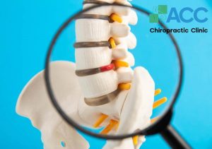 bulging disc treatment