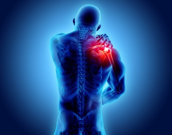 What is Rotator Cuff Tendinitis?