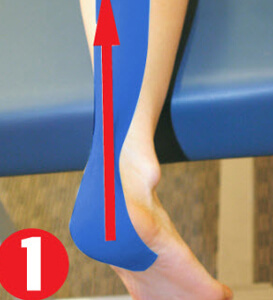 Dán băng dán cơ ở giữa vòm bàn chân, kéo căng qua vùng gân gót chân và đến phần trên của bắp chân