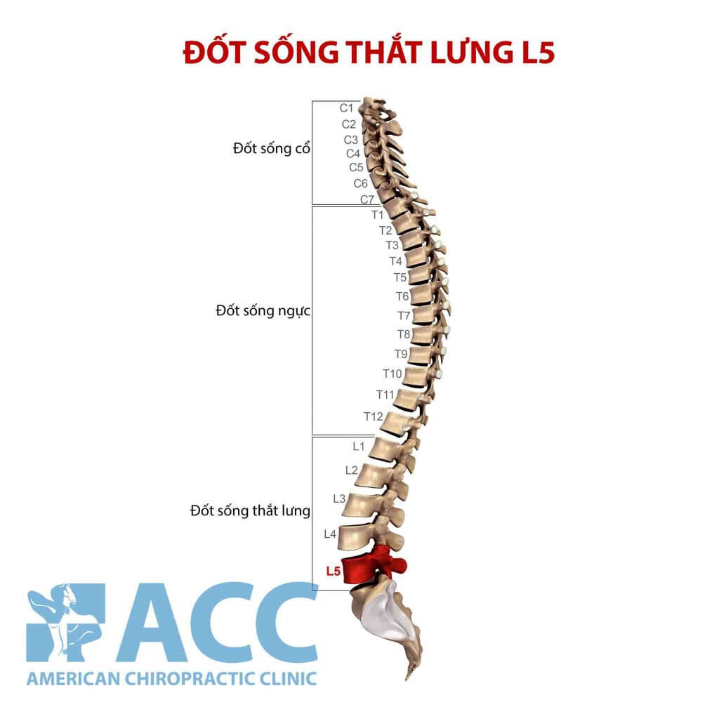 Thoát vị đĩa đệm cột sống thắt lưng L5- S1: Nguyên nhân và ...