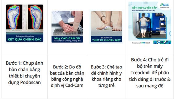 quy trình tầm soát bàn chân bẹt tại ACC