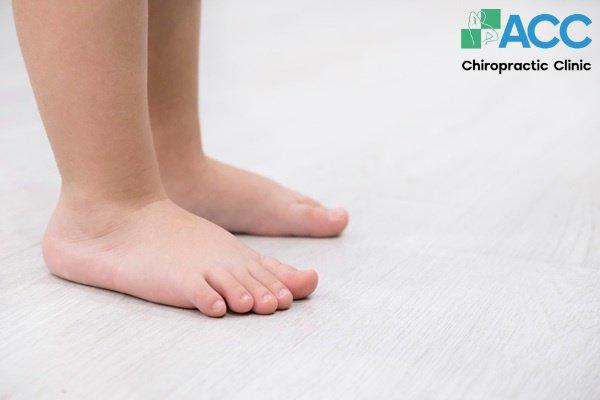 bài tập bàn chân bẹt