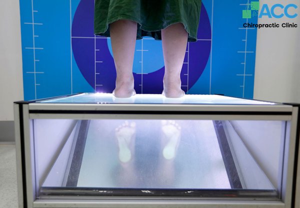 hứng dẫn kiểm tra bàn chân bẹt