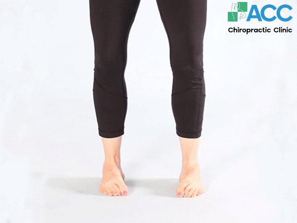 tổng hợp bài tập bàn chân bẹt