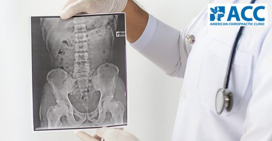 Điều trị viêm cột sống dính khớp