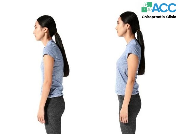 bài tập chống gù lưng tại nhà