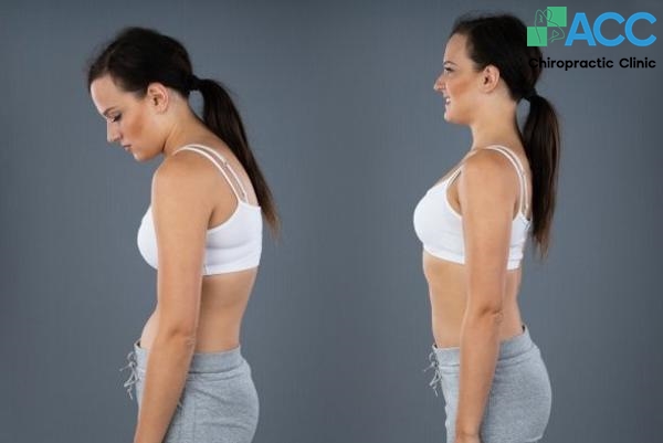 bài tập khắc phục gù lưng