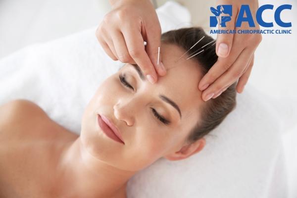 Châm cứu trị đau nửa đầu bên trái có thể gây ra nhiều phản ứng bất lợi như mệt mỏi, đau nhức và bầm tím da.