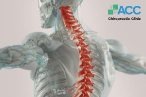 thoái hóa đốt sống cổ chèn dây thần kinh và xử lí