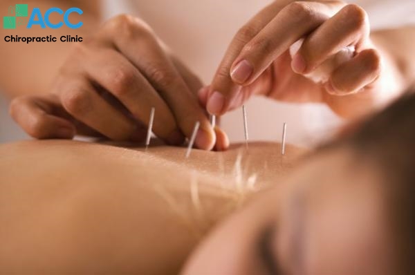 đau lưng dưới bên trái