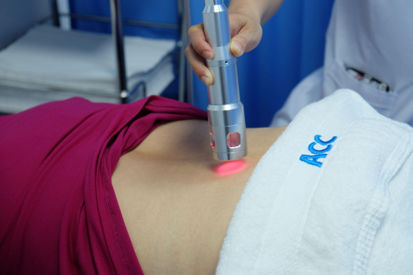 cách giảm đau lưng sau sinh mổ bằng phương pháp chiếu tia laser