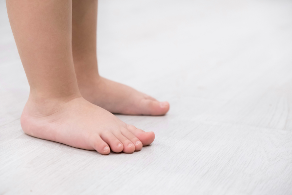 Bàn chân bẹt có thể dẫn đến đau gót chân khi chạy bộ