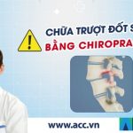 Chữa thoát vị đĩa đệm, trượt đốt sống bằng nắn chỉnh Chiropractic