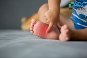 Đừng chủ quan với những cơn đau do hội chứng bàn chân bẹt