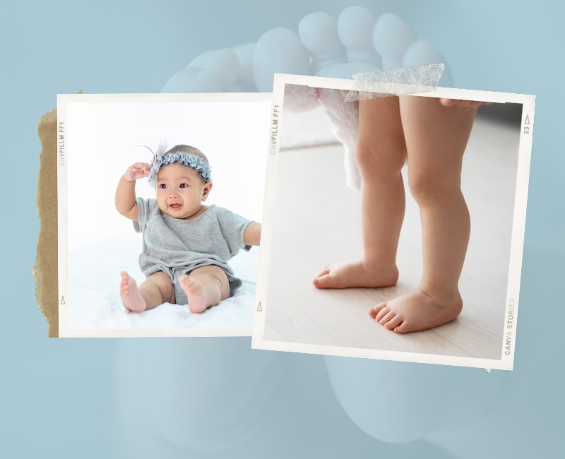 Hầu hết trẻ sơ sinh và trẻ mới biết đi đều có bàn chân bẹt
