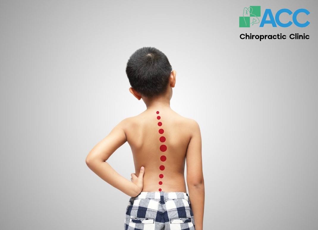 Tổng quan về tình trạng cong vẹo cột sống học đường