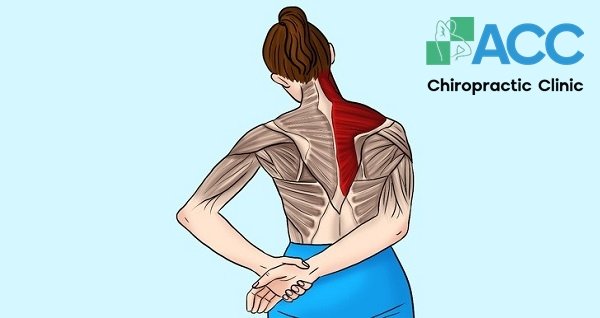 bài tập giảm đau vai gáy