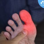 tê đầu ngón chân cái bên trái