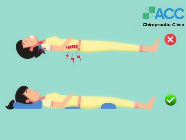 tư thế nằm giảm đau lưng