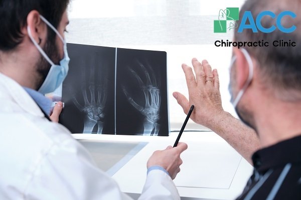 triệu ứng chèn ép dây thần kinh