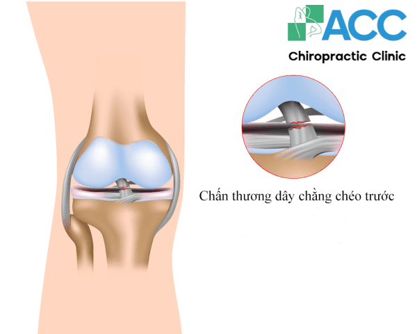 giải phẫu khớp gối