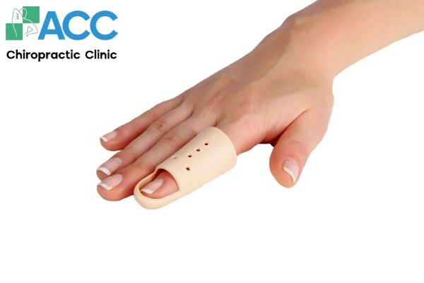 điều trị viêm khớp ngón tay