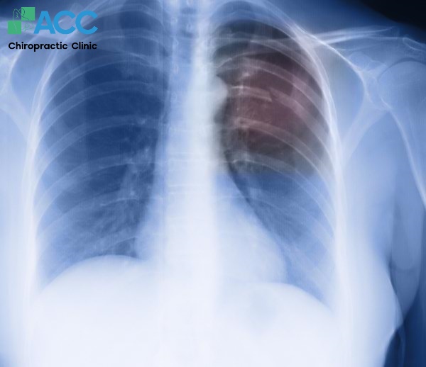 bị đau lưng bên dưới dưới bả vai khó thở