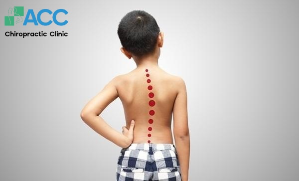 bàn chân phẳng là gì