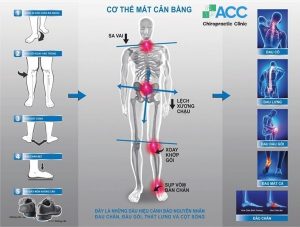 bệnh do bàn chân bẹt