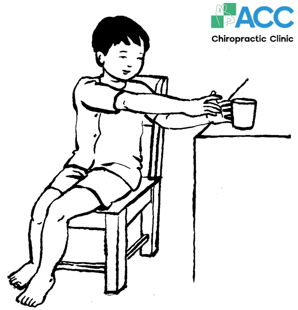 bài tập hỗ trợ chữa vẹo cột sống hiệu quả 2