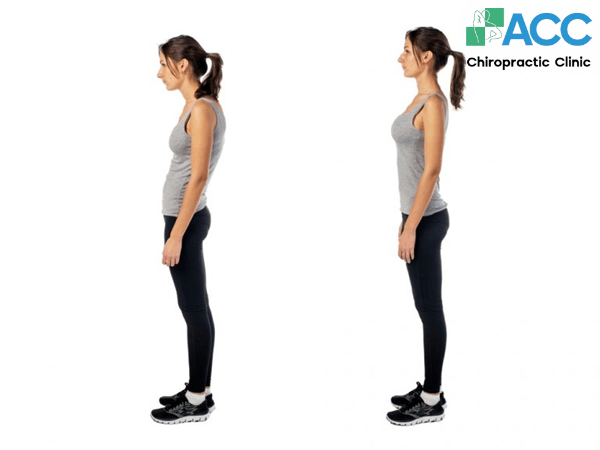 rối loạn cong cột sống