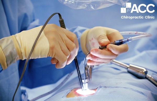 mổ vẹo cột sống có nguy hiểm không