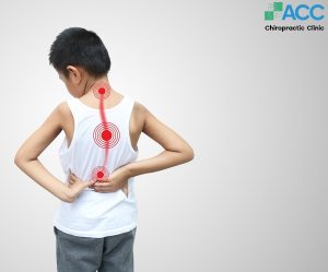 bàn chân bẹt và biến chứng vẹo cột sống
