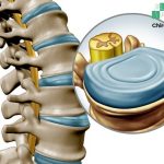 đĩa đệm là gì