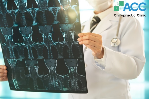 chuẩn đoán vấn đề ở đốt sống cổ
