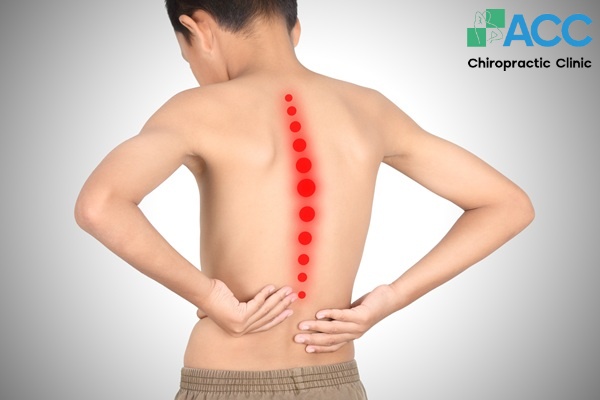 vẹo cột sống ở trẻ