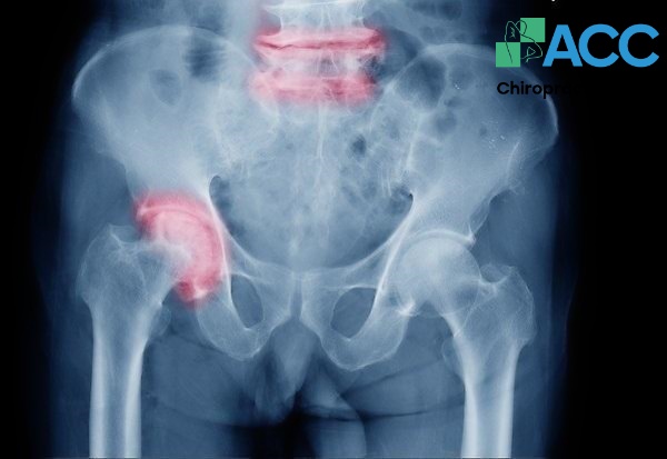 đau lưng dưới ở nam giới