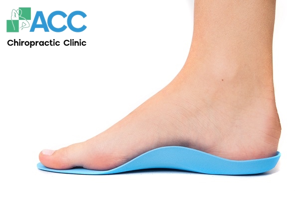 bàn chân bẹt có chữa được không