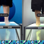 Bé Đăng - thư cảm ơn ACC